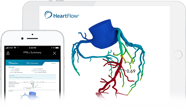 Heartflow-Devices